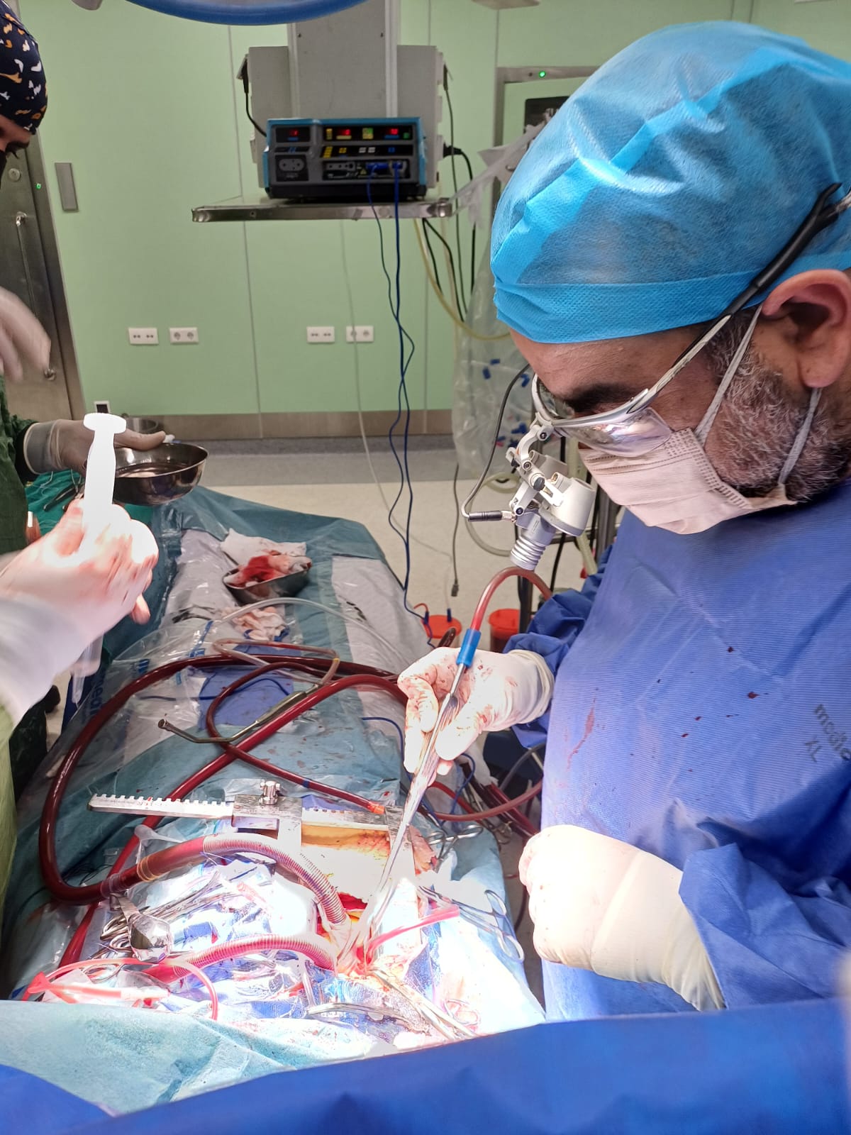 وزارة الصحة تُعلن تفعيل خدمة القسطرة المخية بمستشفى دمنهور التعليمي بمحافظة البحيرة