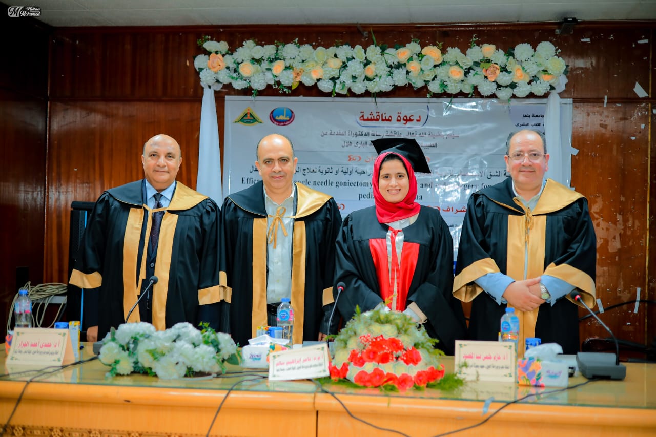 رسالة دكتوراة بقسم طب وجراحة العين بكلية الطب جامعة بنها تضيف طريقة جديدة لعلاج جلوكوما الأطفال بأقل تكلفة