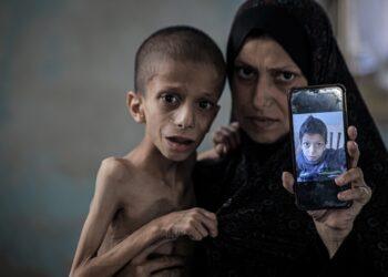عشرات القتلى في غزة وارتفاع وفيات الأطفال جراء المجاعة إلى 103
