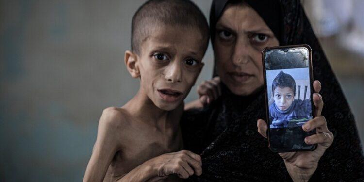 عشرات القتلى في غزة وارتفاع وفيات الأطفال جراء المجاعة إلى 103