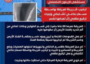 ” مستشفى الزيتون التخصصى” نجاح جديد في إجراء تركيب شريحة لمريضة بواسطة مسمار نخاعي تشابكي وإجراء ترقيع عظمي إثر تعرضها لكسر
