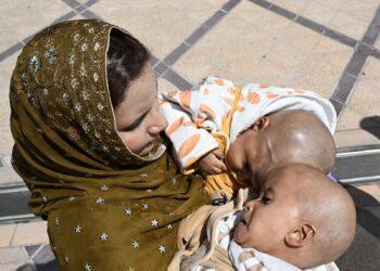 وصول التوأم الملتصق الباكستاني(سفيان ويوسف) إلى الرياض