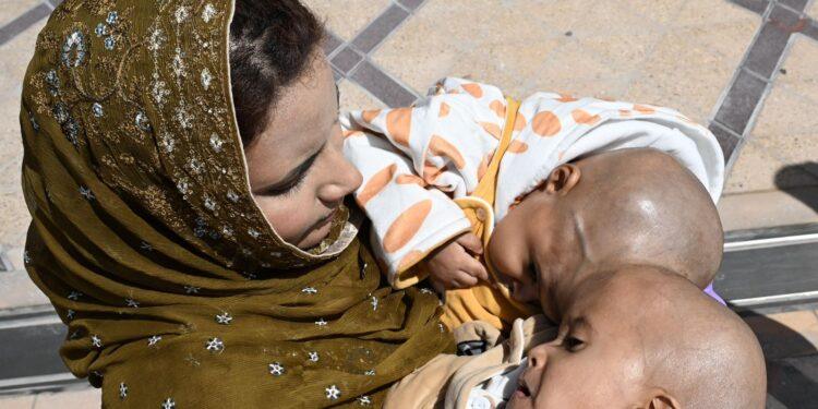 وصول التوأم الملتصق الباكستاني(سفيان ويوسف) إلى الرياض