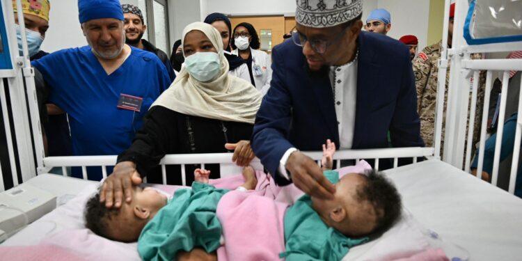 بدء عملية فصل التوأم الملتصق الصومالي “رحمة ورملا” في الرياض