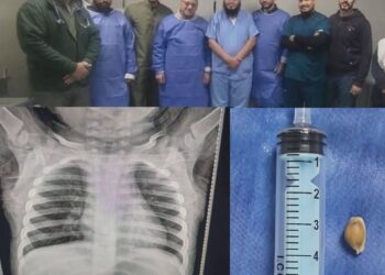 طفل رضيع يعود للحياة بعد توقف التنفس والقلب.. ملحمة طبية جديدة بمستشفى كفر الشيخ العام